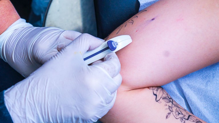 paraiba-oferta-contraceptivo-subdermico-e-capacita-profissionais-da-saude